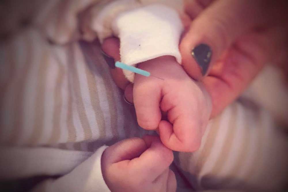 Ett barn som får akupunktur